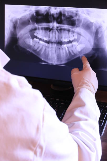 Best Emergency Treatment for Oral Infections in Rockville, CT
